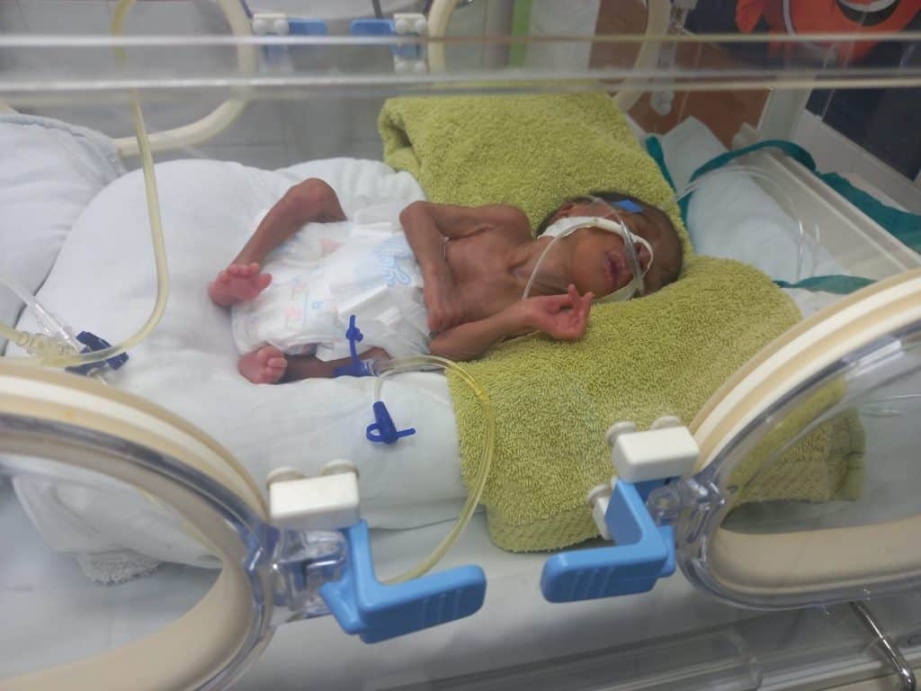 ¿Por qué es tan importante el surfactante y la alimentación parenteral? Dentro del proyecto de Neonatología este año hemos llevado 2 respiradores de CPAP y los siguientes pasos, para mejorar la supervivencia de los niños prematuros, es iniciar la nutrición enteral y la administración de surfactante. La administración de surfactante se realiza desde los años 80, y fue uno de los acontecimientos neonatales que revolucionaron el pronóstico de estos niños, ya que uno de los grandes problemas para el prematuro es que tienen los pulmones inmaduros, debido a la escasez de surfactante, que no ha dado tiempo a producirse en cantidades adecuadas. Por supuesto esto es más grave cuanto más prematuro es el recién nacido. Es por eso que tras la incorporación de las CPAP será el surfactante la medida fundamental para mejorar la supervivencia. Y otra de las medidas fundamentales es la administración de nutrición parenteral, ya que también el aparato digestivo de los prematuros es inmaduro y necesita nutrición parenteral para alimentarse durante los primeros días.